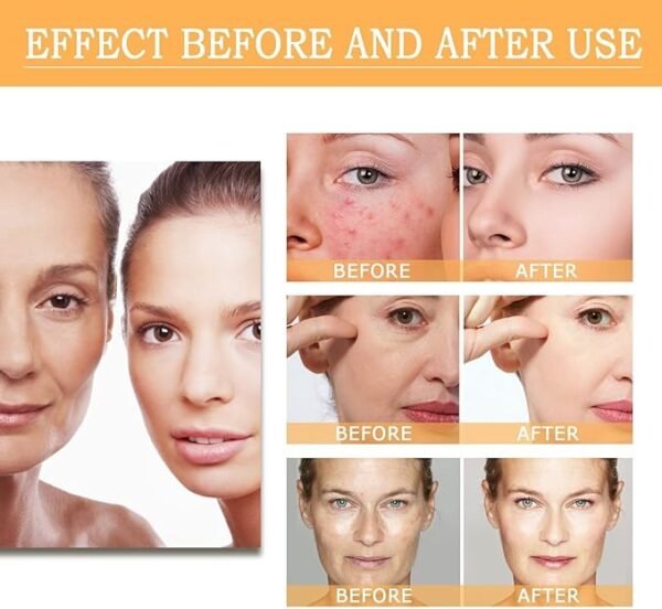 Glycolic Acid 7% Toning Solution 8.44 Fl Oz, Glycolic Acid 7% Exfoliating Toner, Body Essence - Image 4