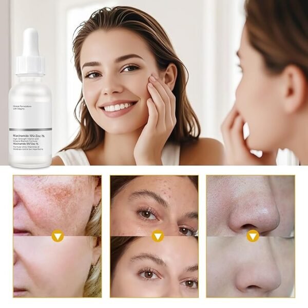 Niacinamide Serum for Face, Niacinamide 10% + Zinc 1% Serum for Oil Control, Pores Minimizer, Tones Skin, With Hyaluronic Acid for Deep Hydration, 30ml - Image 3